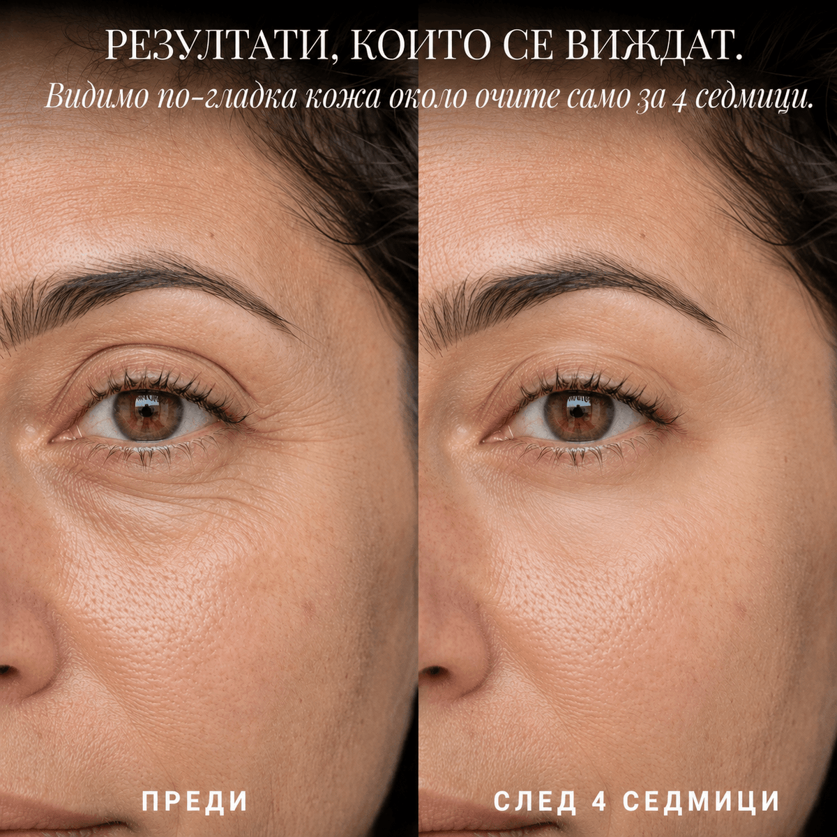 GlowEye™ - Корейски микрокристални пачове за по-малко торбички и бръчки около очите